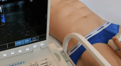 Diagnostikas iespējas varikozām apakšējo ekstremitāšu vēnām